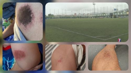 El mal estado del césped causa heridas a los niños en los campos de Galindo