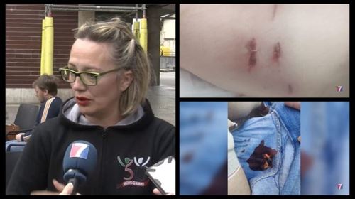 Un perro ataca y hiere a un niño de 9 años en Portugalete